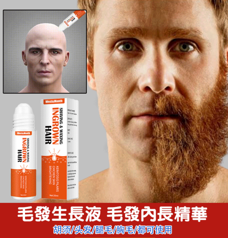 買二送一！West&Month毛髮逆生長精華