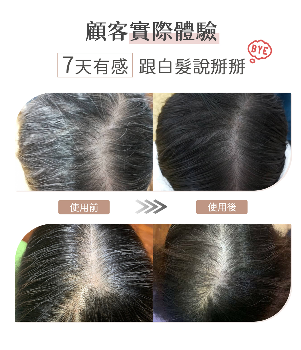 買一送一【日本熱銷】你有白髮煩惱嗎？快來試試一噴一抹就黑髮 全新第五代髪速黑 植萃護髮素噴霧+植萃護髮素